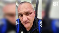 46 годишен мъж изпадна в мозъчна смърт след побой пред нощен