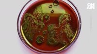 Картини нарисувани с бактерии Това изкуството с микроорганизми се нарича
