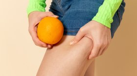 Целулит - защо се появява и какво наистина работи срещу него