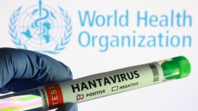 Д-р Аспарух Илиев: Хантавирусът няма да предизвика нова пандемия