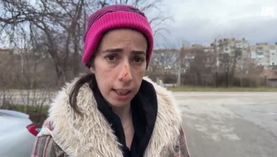 "Кучето ми беше в кръв, мен ме нахапа по носа": Разказ за жестоко нападение от овчарка