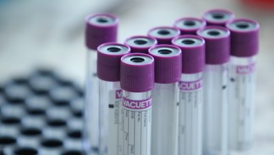 Учени от БАН разгадаха коронавируса, търсят терапия с фина дисекция на клетките