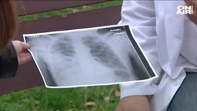 Пневмония убиец - развива се за часове и зависи от имунитета!