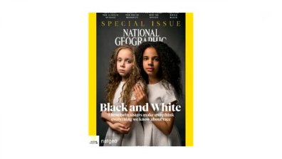 Разноцветни близначки огряха корицата на "National Geographic" 