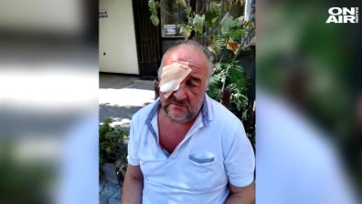 Оперен певец загуби зрението си след побой, пеел българския химн