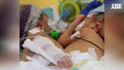 Фондът за деца отказа да плати за операция на сиамските близнаци от Сливен