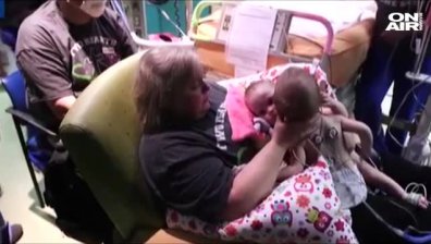 Тежко съединени сиамски близнаци получиха нов шанс за живот
