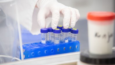 Скритата заболеваемост от Ковид-19: Болните със затруднен достъп до безплатен PCR тест