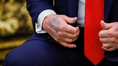 Има ли проблеми Тръмп със здравето? Вече не крие синините по ръцете си (+СНИМКИ)