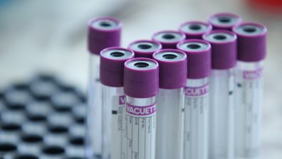 СЗО ще изпрати много нови тестове за Ковид-19 на по-бедните страни