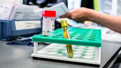 Избягалият от Самоков с положителен PCR е бил изписан дисциплинарно