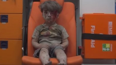 Снимка на дете, спасено от развалините в Алепо, трогна социалните мрежи