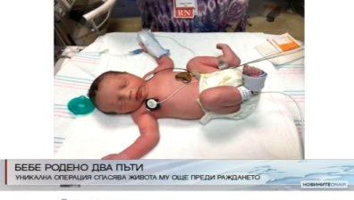 Бебе се роди два пъти след уникална операция