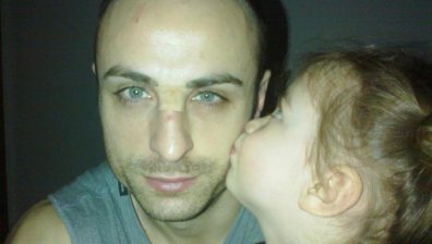 Голямата щерка изцерява одраскан нос на Бербатов