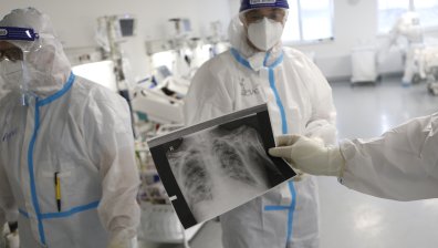 2/3 от тежко преболедувалите Ковид-19 страдат от оплаквания 6 месеца по-късно