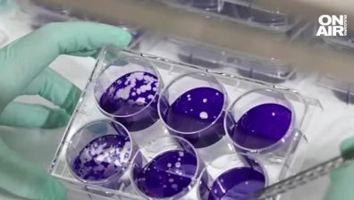 Дете разви парализа след заразяване с полиомиелит в САЩ