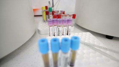 Седма жертва на коронавируса у нас - възрастна жена почина в Благоевград