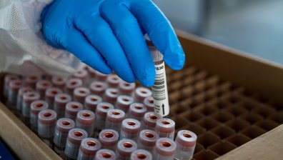 Новият тест срещу Ковид-19: Ще помогне ли за доказване на ефекта от ваксините?