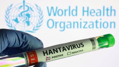 Д-р Аспарух Илиев: Хантавирусът няма да предизвика нова пандемия