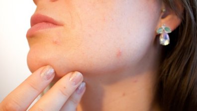 Въоръжете се с кремове, серуми и етерични масла за здрава кожа през есента