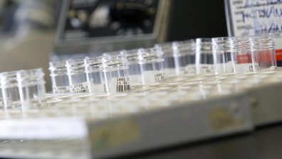 Откриха ензим, който подпомага проникването на Ковид-19 в тялото ни