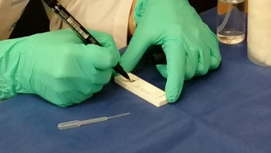 Неврологията в Ловеч затвори заради заразен с Ковид-19