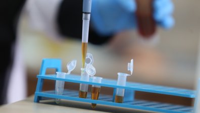Леките форми на коронавирусна инфекция не водят до имунитет