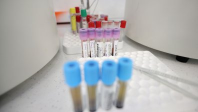 166 новозаразени при 790 PCR теста