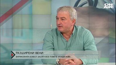Разширените вени все по-често засягат и млади хора