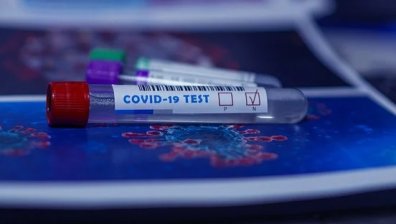 Личните лекари ще издават направления за PCR тест