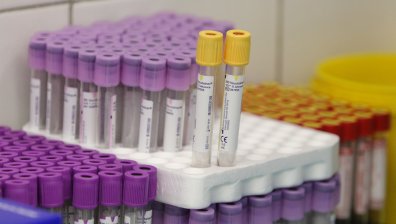 Над 70% от случаите на коронавирус в Лисабон са от по-заразния Делта вариант