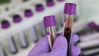 Властите в Ню Йорк обявиха извънредна ситуация заради маймунската шарка