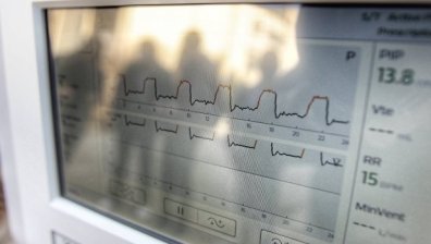 МЗ дава 30 млн. лв. за допълнителна медицинска апаратура за Ковид-зоните