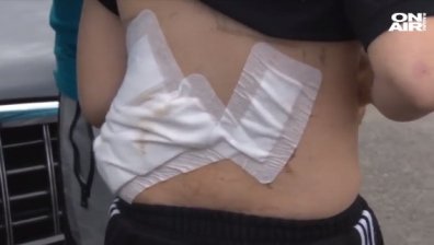 Прокуратурата проверява случая с нахапаното от куче дете в Крън