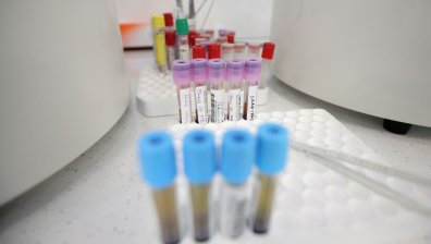За последните 24 часа: 2037 новозаразени, 79 са починалите