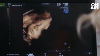 Медицинско чудо или намеса в Божиите дела: Бебе с ДНК на трима родители