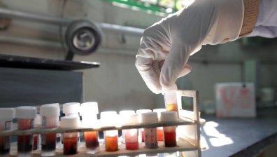 Учени откриха потенциално лекарство срещу ХИВ