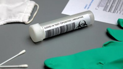 Пациенти и медици в център за хемодиализа в Добрич с положителни проби за Ковид-19