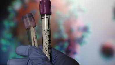 10-дневната карантина на влизащи у нас се отменя след отрицателен PCR до 24 ч.