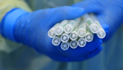 Създадоха уникален антибиотик, унищожава най-устойчивите бактерии