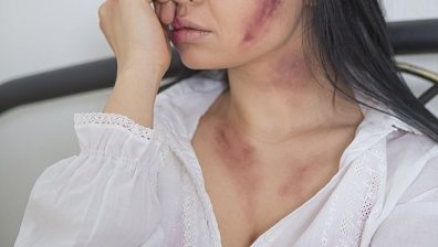 Задържаха насилник, системно биел жена си с вила