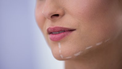 Филърите в лицето крият риск от запушване на артерии, кожна некроза и дори слепота