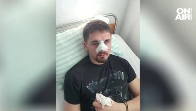 Цивилни полицаи пребили жестоко 19-годишно момче в Плевен?