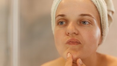 Грижа за мазната кожа