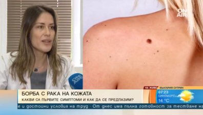 "Евромеланома 2019": Дерматолози преглеждат безплатно за рак на кожата