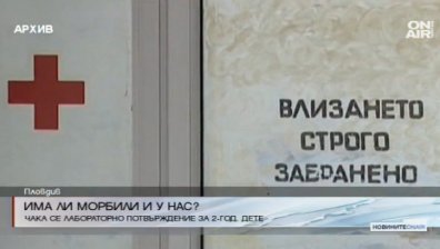 Изолираха 2-годишното дете със съмнение за морбили