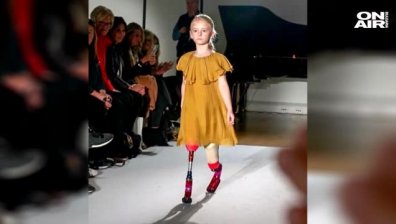 Модел с увреждания покори британските модни подиуми