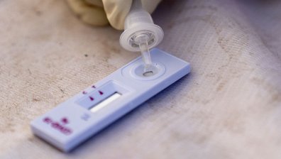 Проф. Чорбанов: Ваксините, базирани на РНК, са изключително неустойчиви