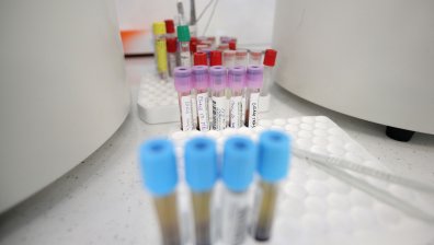 За денонощие: 1246 новозаразени с Ковид-19 и 41 починали