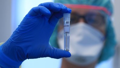 Плешивите мъже са по-предразположени към тежки симптоми на Ковид-19